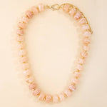 Marbled Muse Chunky Bead Necklace